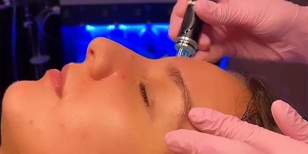 Hydrafacial - Glow TF Up Skincare Services