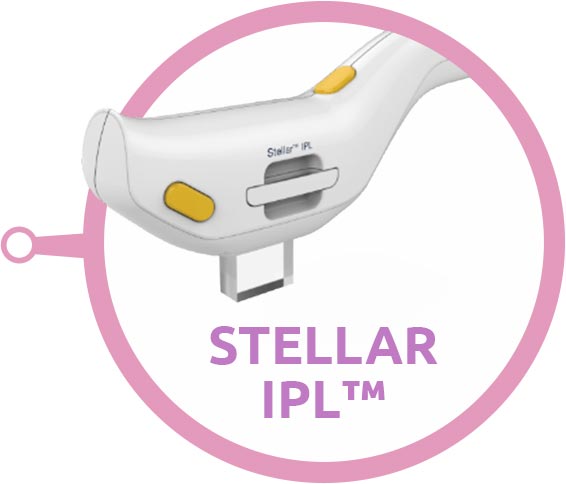 Stellar IPL Skin Rejuvenation