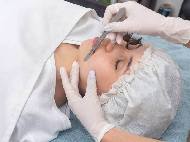 What Is Dermaplaning?