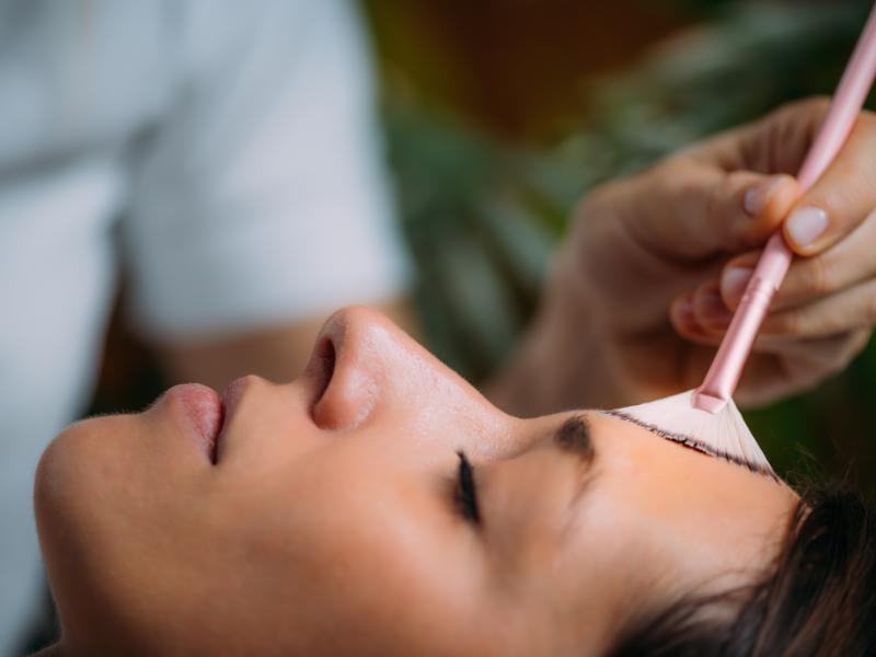 What is the Day-by-Day Recovery Timeline for a VI Peel?