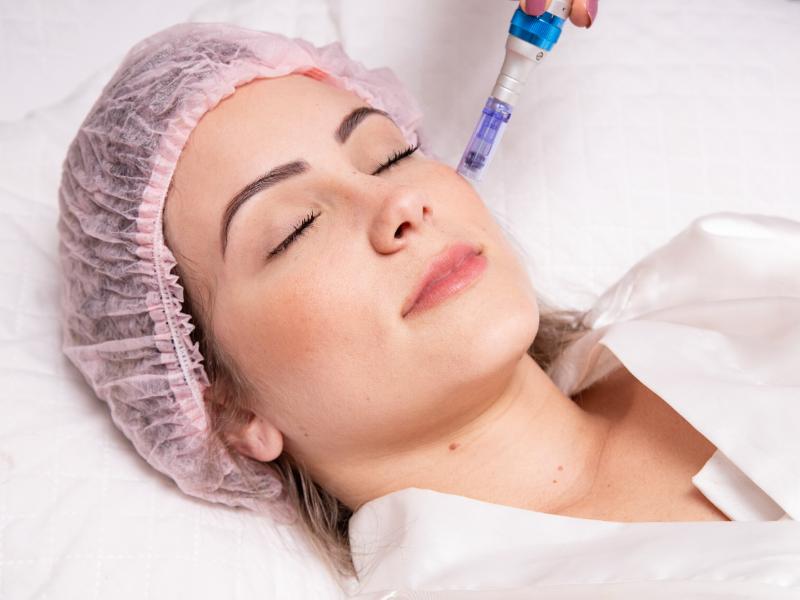 Who Should I Choose for Microneedling Near Dearborn Heights, MI?
