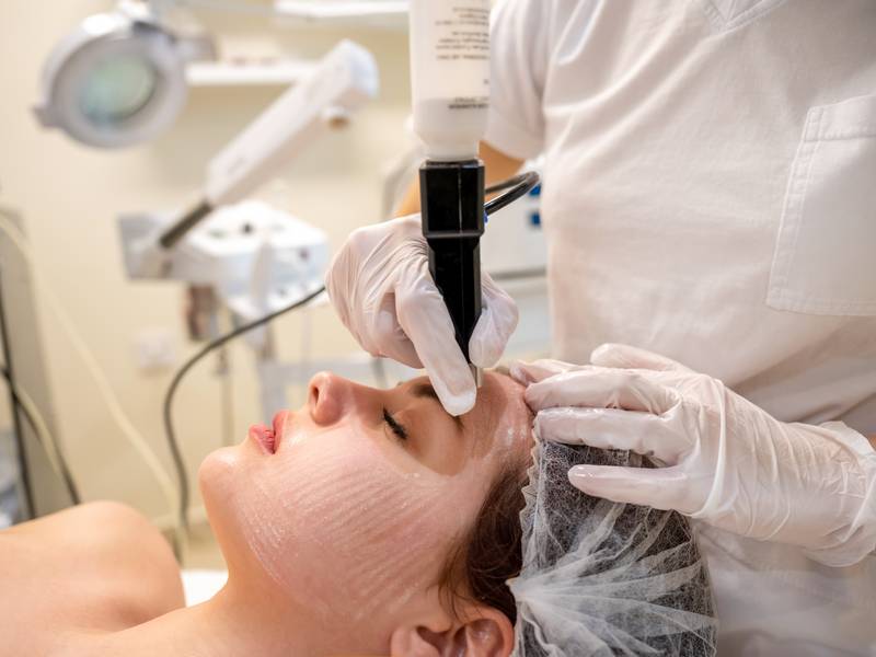 Why Professional Microneedling Beats At-Home Dermarollers